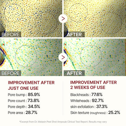 2-Pack Rice Peeling Shot Glow - Soft Exfoliating Scrub